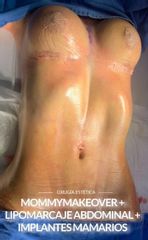 Euroderma