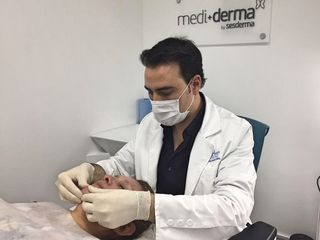 Aplicación de peeling