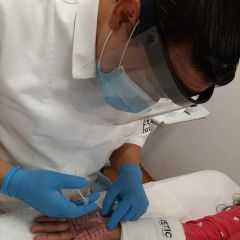 Tratamiento Hiperhidrosis de Manos