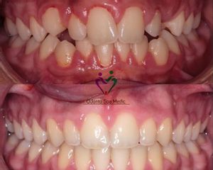 Ortodoncia - Odonto Spa Medic