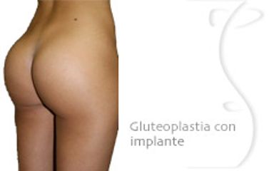 foto_gal_con_gluteo_con_impl