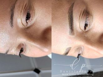 Microblading antes y después - 876576