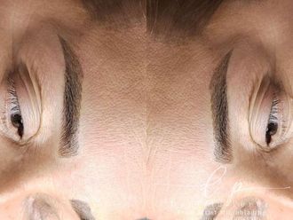 Microblading antes y después - 876577