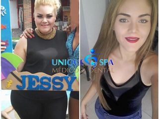 Mesoterapia