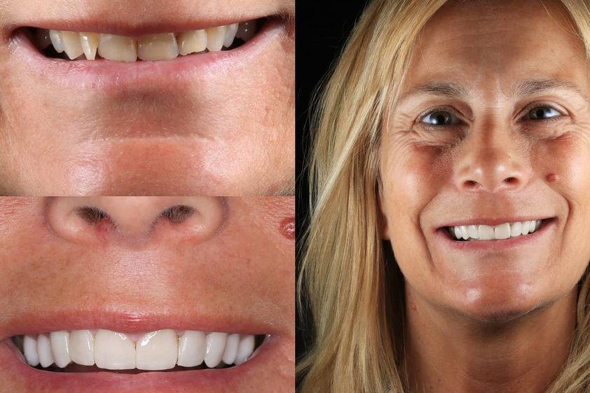 Ortodoncia antes y después - 663030