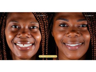 Implantes Dentales - 663583