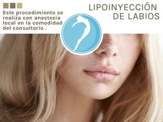 Lipoinyección de labios 