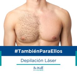 Depilación Láser Masculina | Venus Concept | Venus Velocity