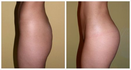 Acropolis Medical Spa 