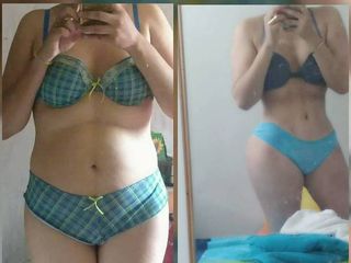 Antes y después de Lipo HD