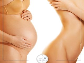 Abdominoplastia y lipoescultura
