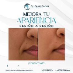 Dr. César Cortés Mendoza - Rejuvenecimiento