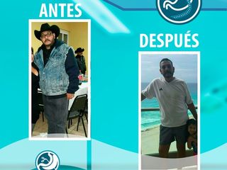 Antes y después de By pass