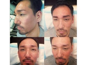 Micropigmentación antes y después - 641909
