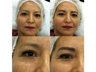 Antes y después de Micropigmentación
