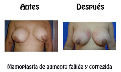 Cirugía plástica reconstructiva