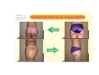 Drenaje linfático - 637839