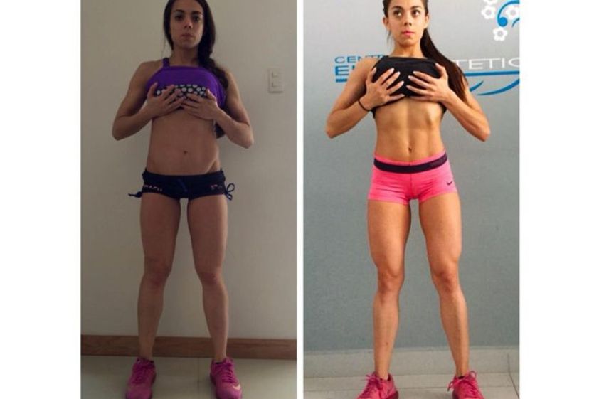 Carboxiterapia antes y después - 641445