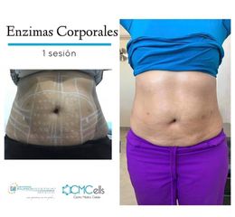 ENIMAS CORPORALES - CMCells