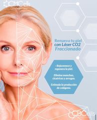 Laser Co2 Fraccionado - CMCells