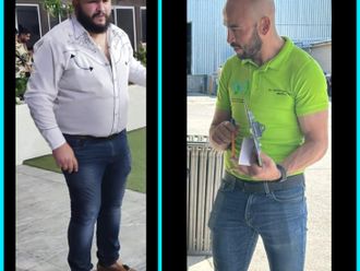 Balón gástrico antes y después - 857920