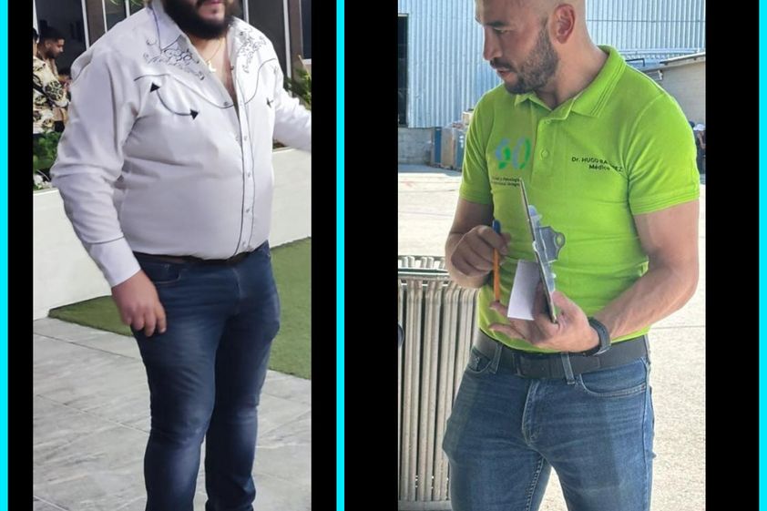 Balón gástrico antes y después - 857920