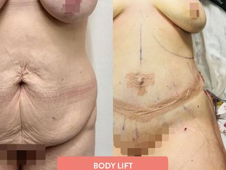 Lifting - 641410