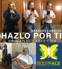 Cirugía Plástica 