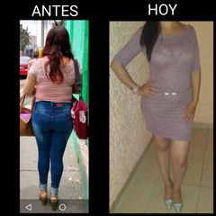 Antes y después de Liposucción