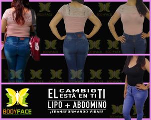 Antes y después de Abdominoplastia