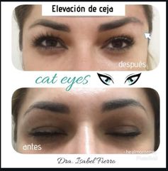 Cat Eyes - Clínica Heal Aesthetics