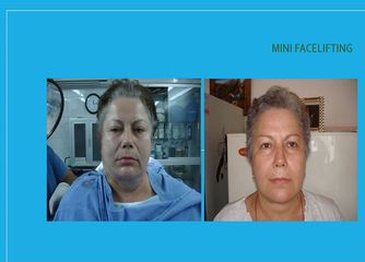 Dra. Georgina Cuevas Maravillas