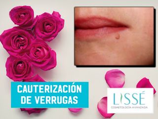 Lisse Cosmetología Avanzada  