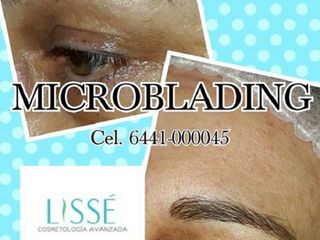 Antes y después de Microblading