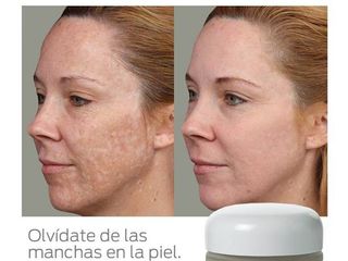 Lisse Cosmetología Avanzada   