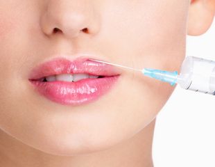 Inyectables para el aumento de labios 