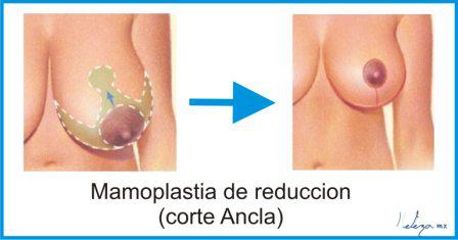 Beleza