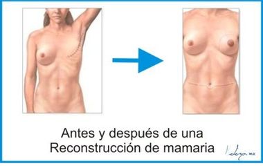 Beleza
