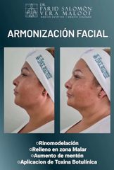 Armonización facial - Dr. Farid Vera