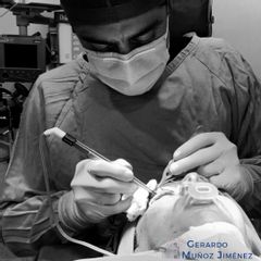 Blefaroplastia