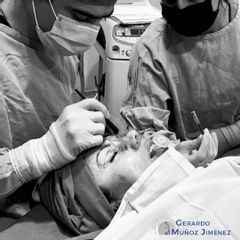 Blefaroplastia