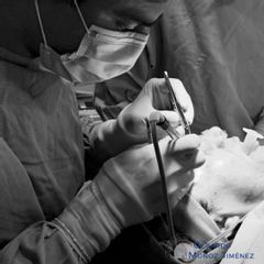 Blefaroplastia