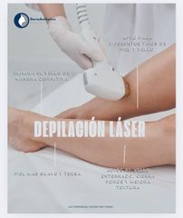 Depilación Láser - Derma Aesthetics PDC