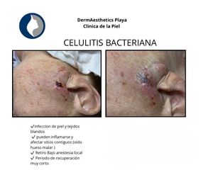 Tratamientos Faciales - Derma Aesthetics PDC