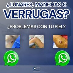 Verrugas - Derma Aesthetics PDC