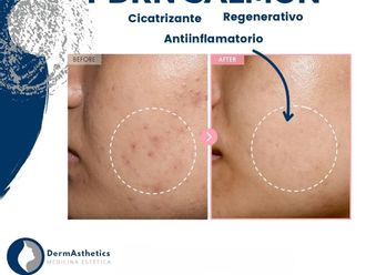 Tratamientos faciales antes y después - 877132
