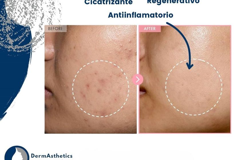 Tratamientos faciales antes y después - 877132