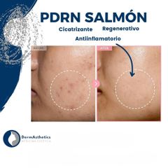 Tratamientos Faciales - Derma Aesthetics PDC