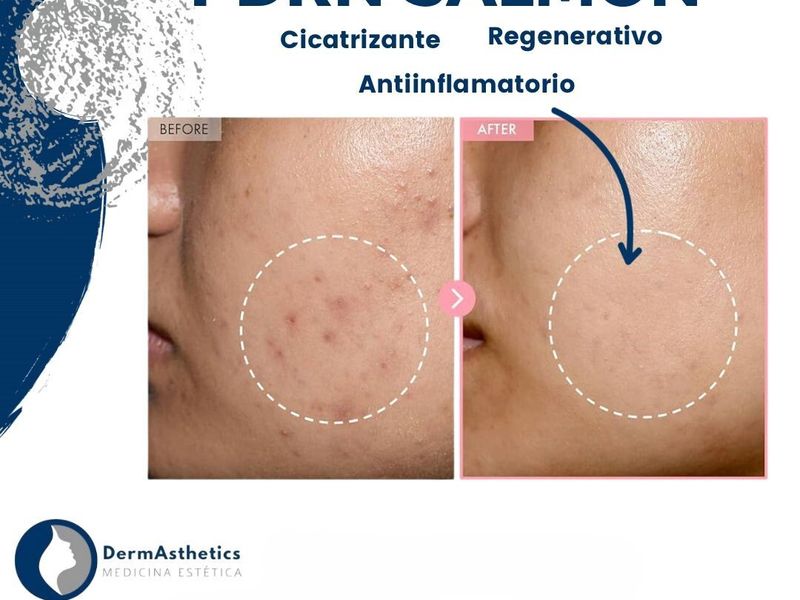 Derma Aesthetics PDC