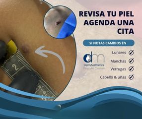 Derma aesthetic
